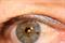 אבחון אירידולוגי להפרעות קשב