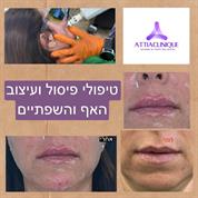 Attia Clinique