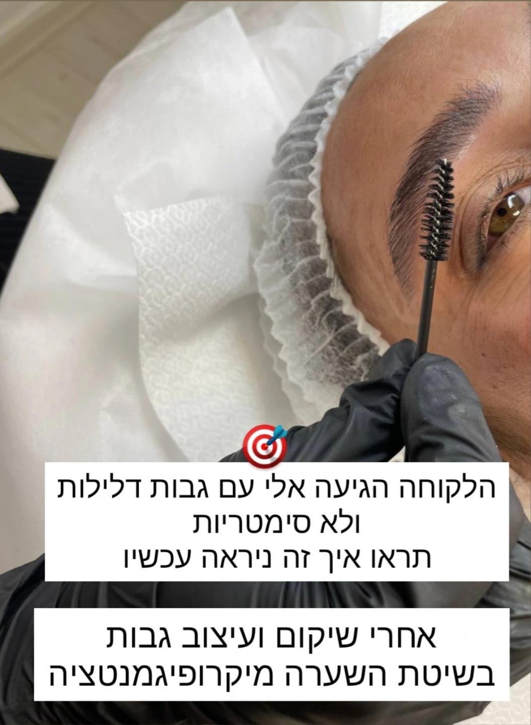 שיקום ועיצוב גבות בשיטת השערה מיקרופיגמנטציה אצלי בקליניקה