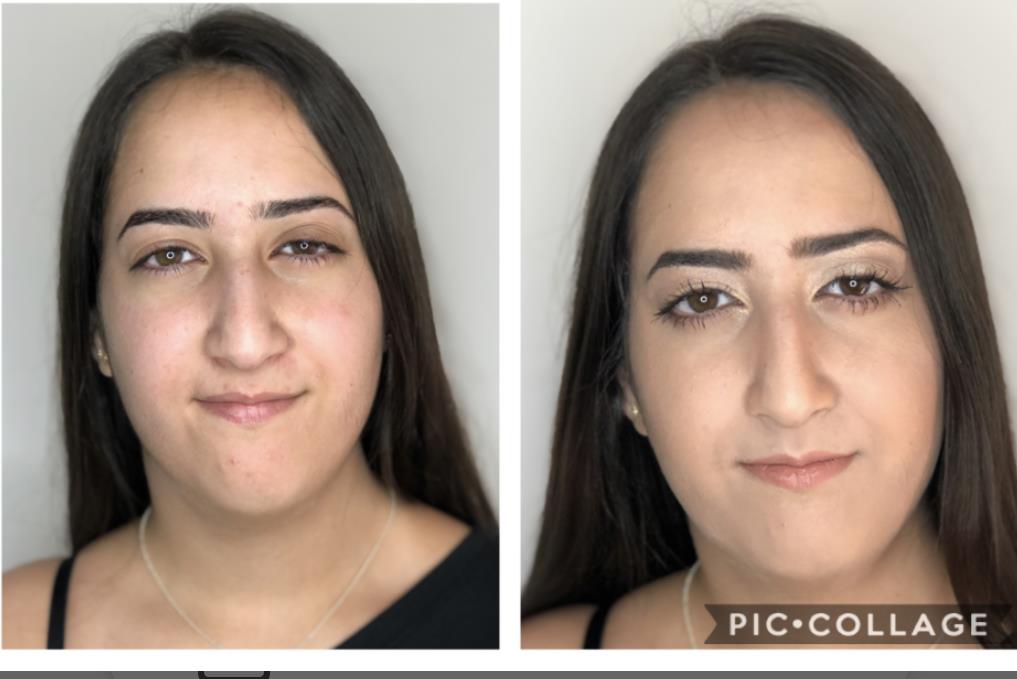 רינה ארליך
