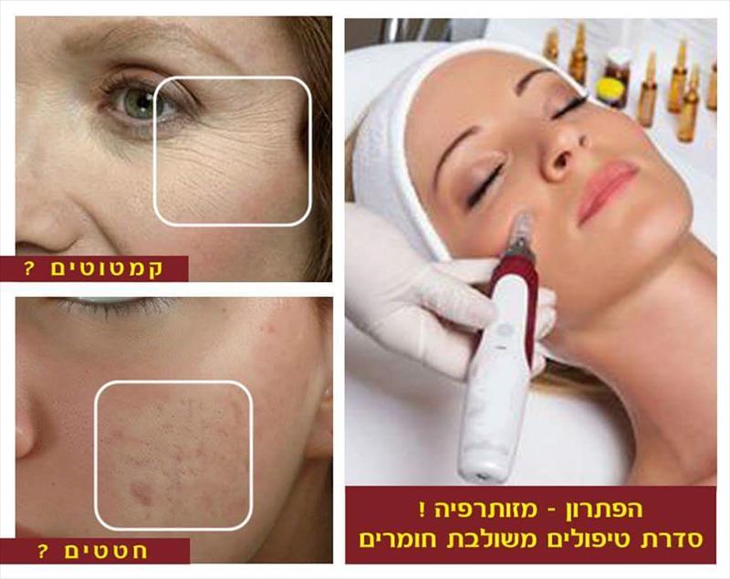 נודלינג ( מזותרפיה הטיפול העדכני ביותר)
