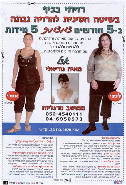 צמצום היקפים