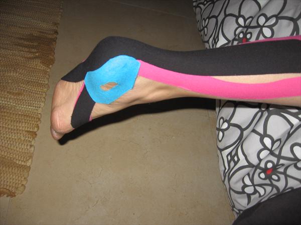 kinesio tax therapy