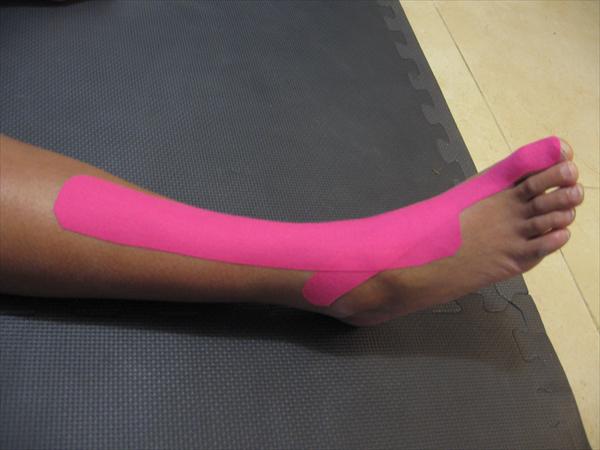 trigger points therapy