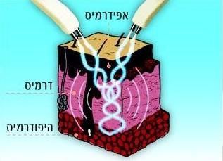 פעולת המכשיר לחיזוק שרירי הפנים והחייאת העור