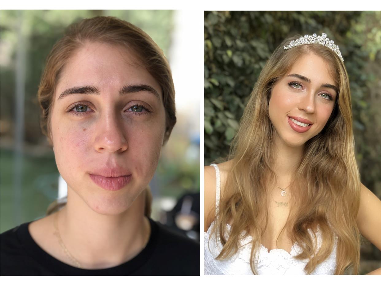 רינה ארליך