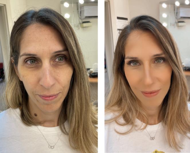 רינה ארליך
