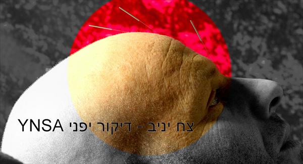 דיקור יפני YNSA