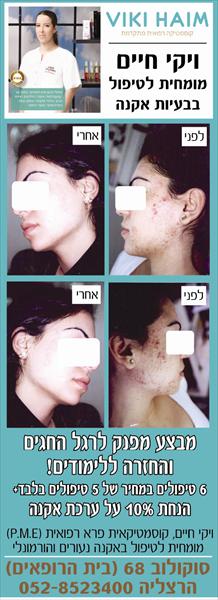 ויקי חיים בעיתונות