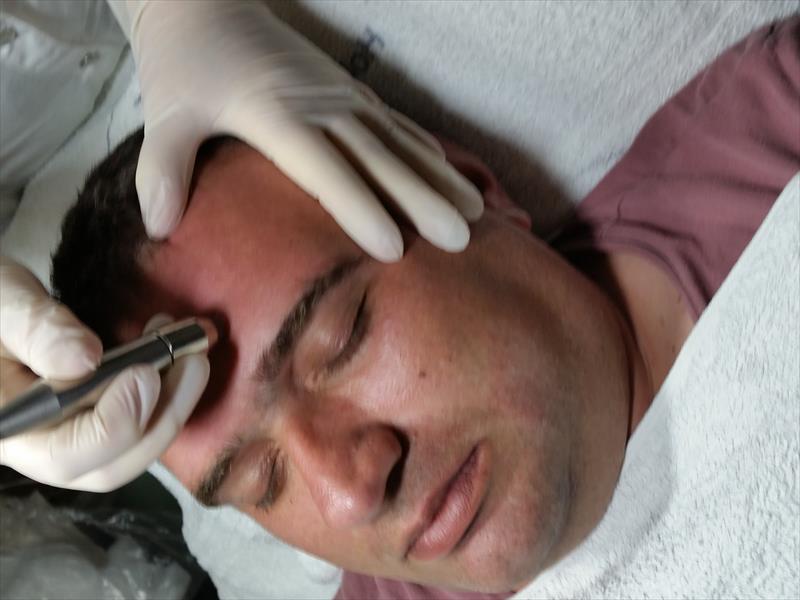 ניקוי פנים עם פילינג יהלום