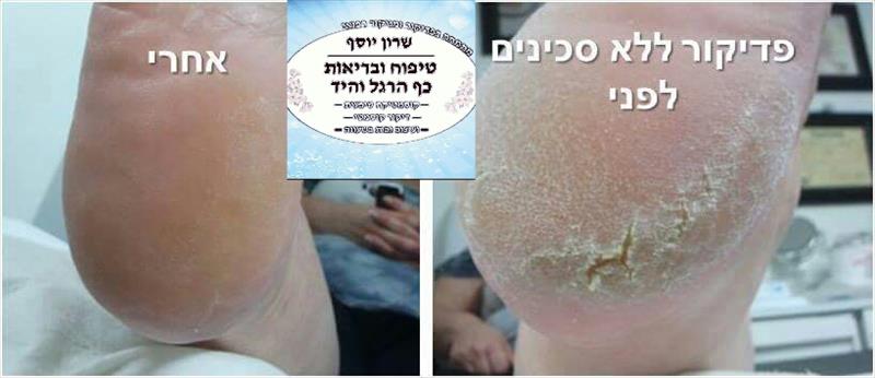 טיפוח ובריאות