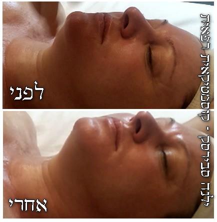 טיפול יופי קלאסי