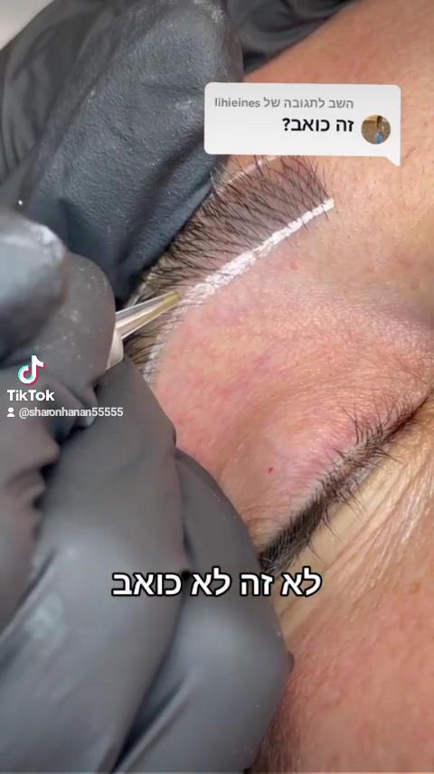 האם זה כואב?