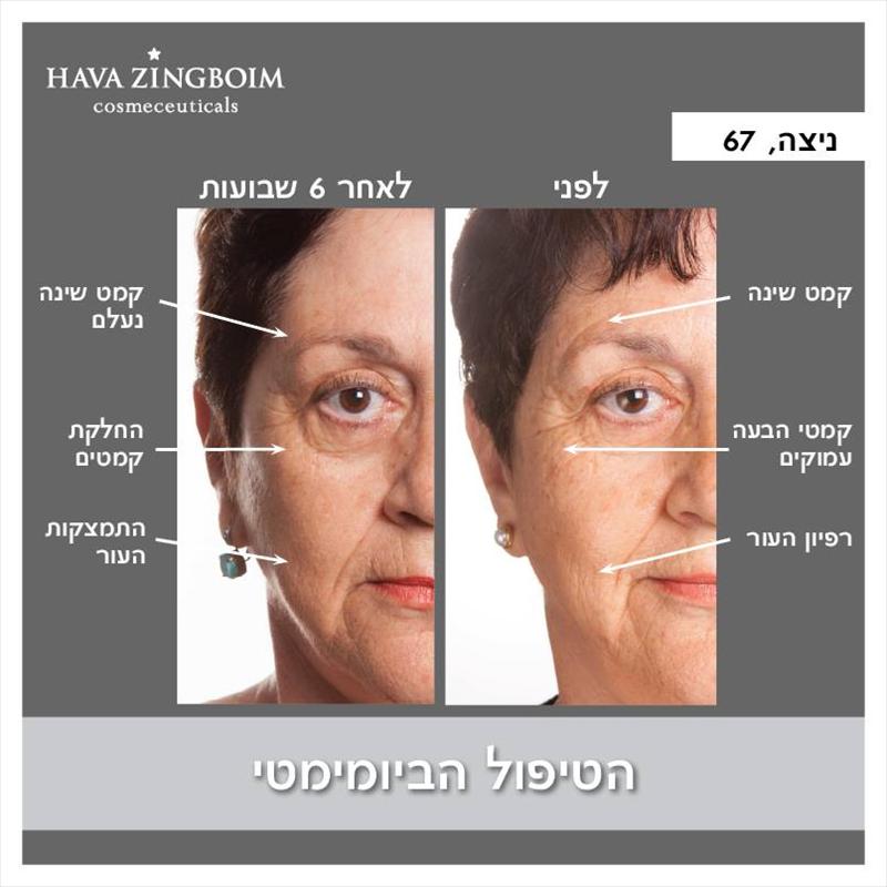אנטיאיג'ינג