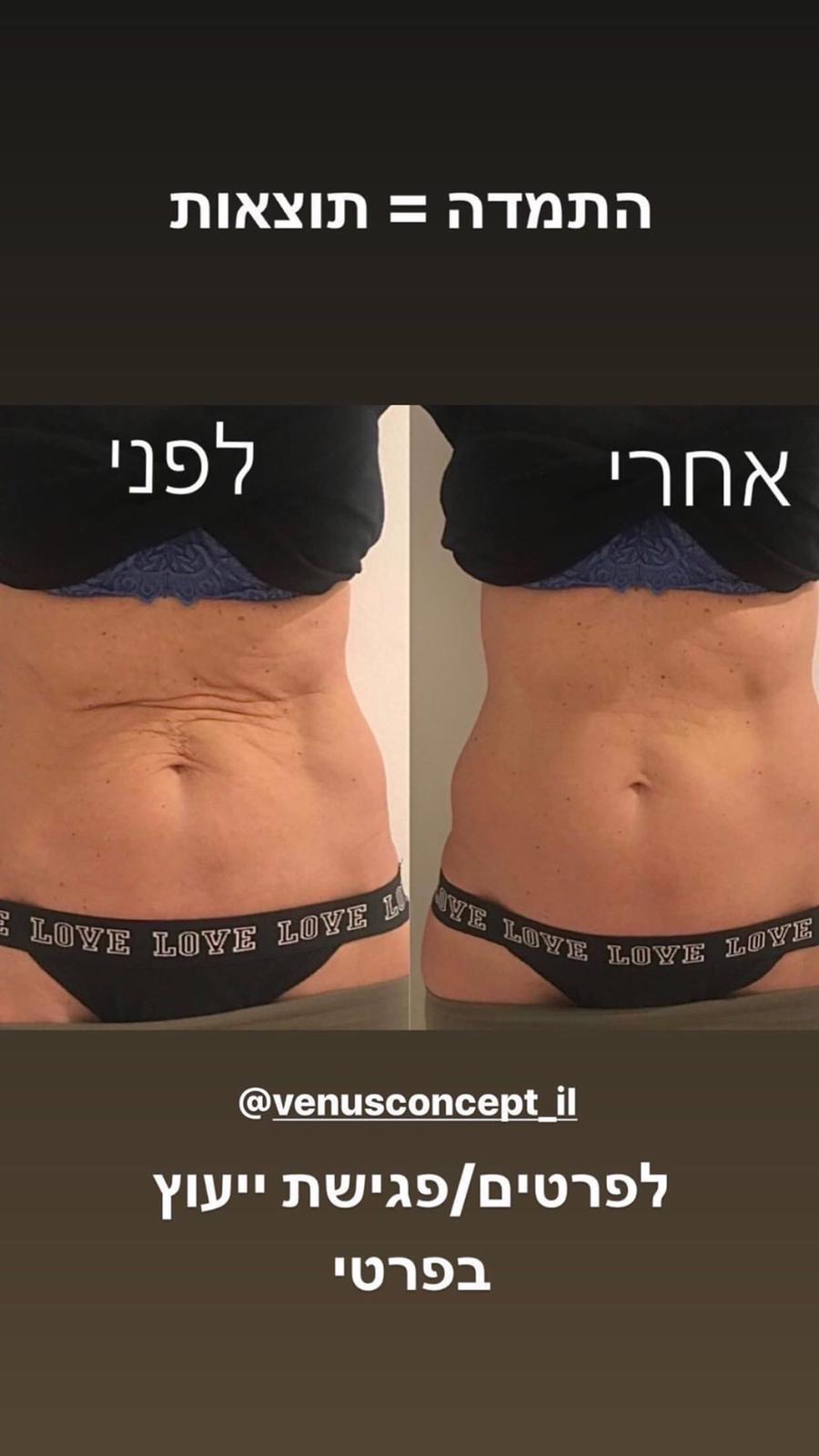 לפני ואחרי