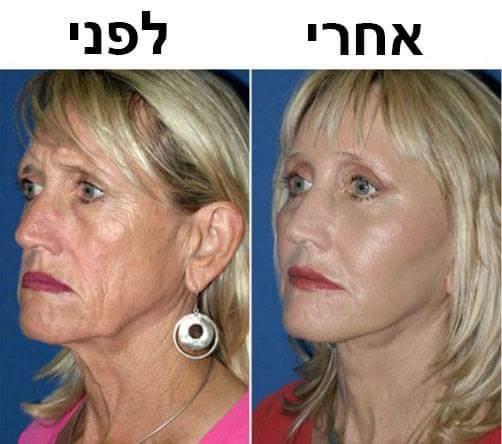אסתטיקה רפואית