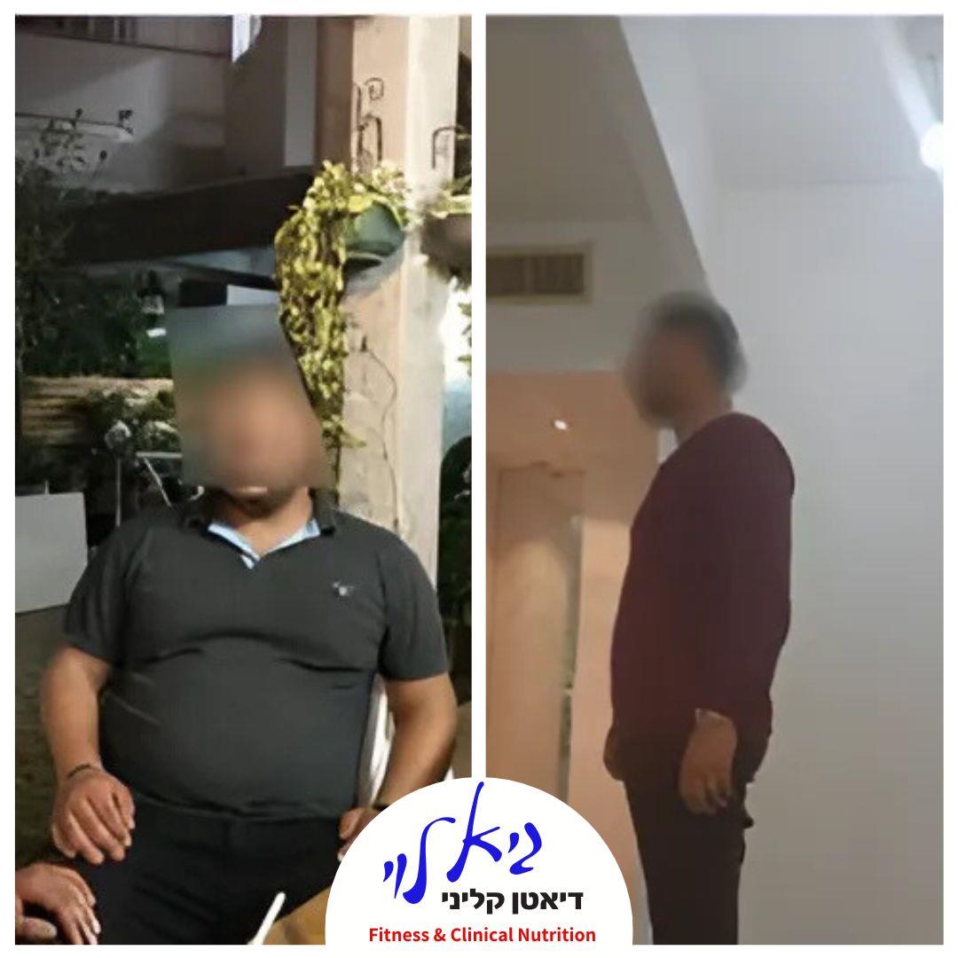 טיפול בהשמנה גברים