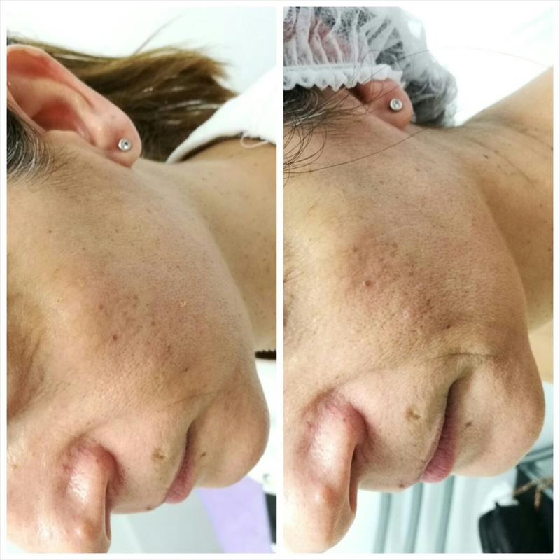 לפני ואחרי
