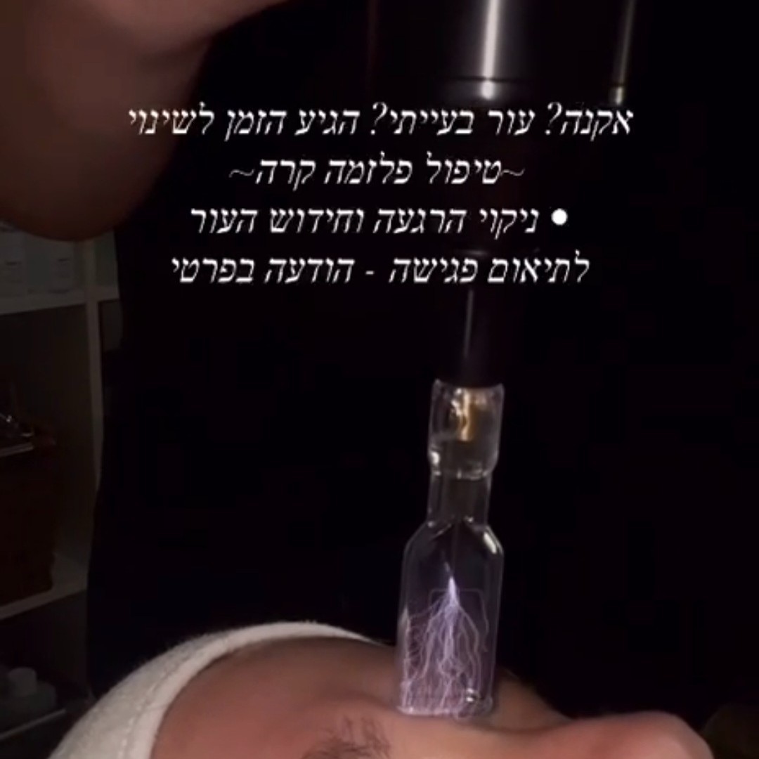 פלזמה קרה