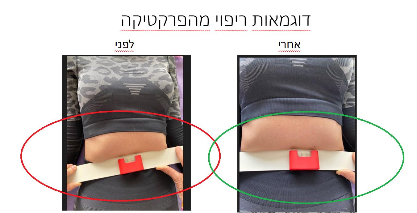 יישור רוחני חד פעמי