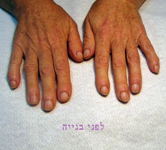 לפני בניית ציפורניים