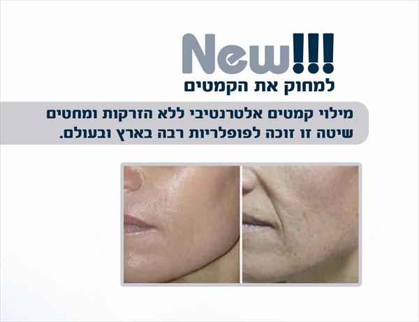 חדש